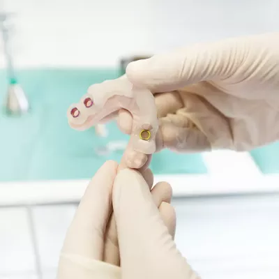 Nahaufnahme einer Implantatschablone, die von einer Person mit Handschuhen gehalten wird. Im Hintergrund sind zahnmedizinische Instrumente.